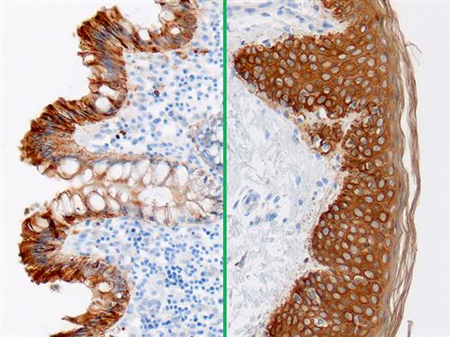 3235B | Control Slides:Immunopathology; Cytokeratin AE1/AE3